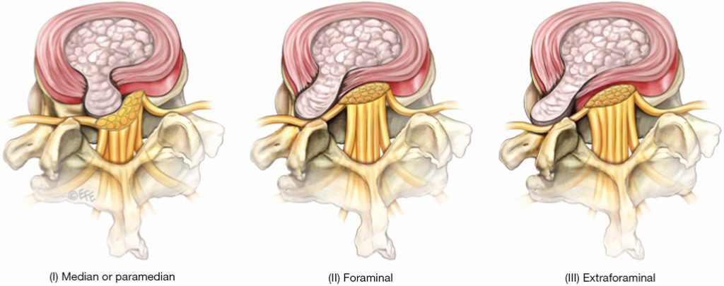 A series of three images showing the anatomy of the pelvic region.