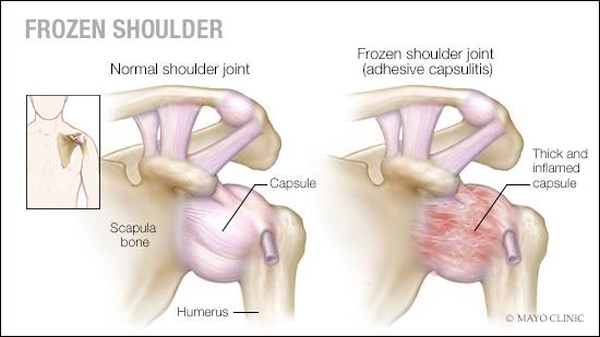 A diagram of the shoulder joint and its application.